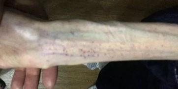 4个月引产吃瓜视频,一场引发社会热议的瓜视频事件